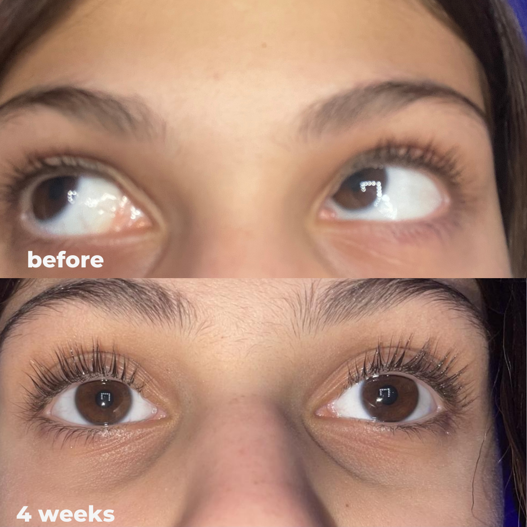 Magic Eyelash Serum