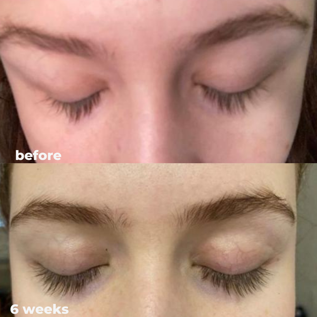 Magic Eyelash Serum