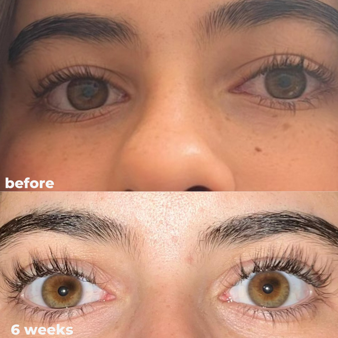 Magic Eyelash Serum