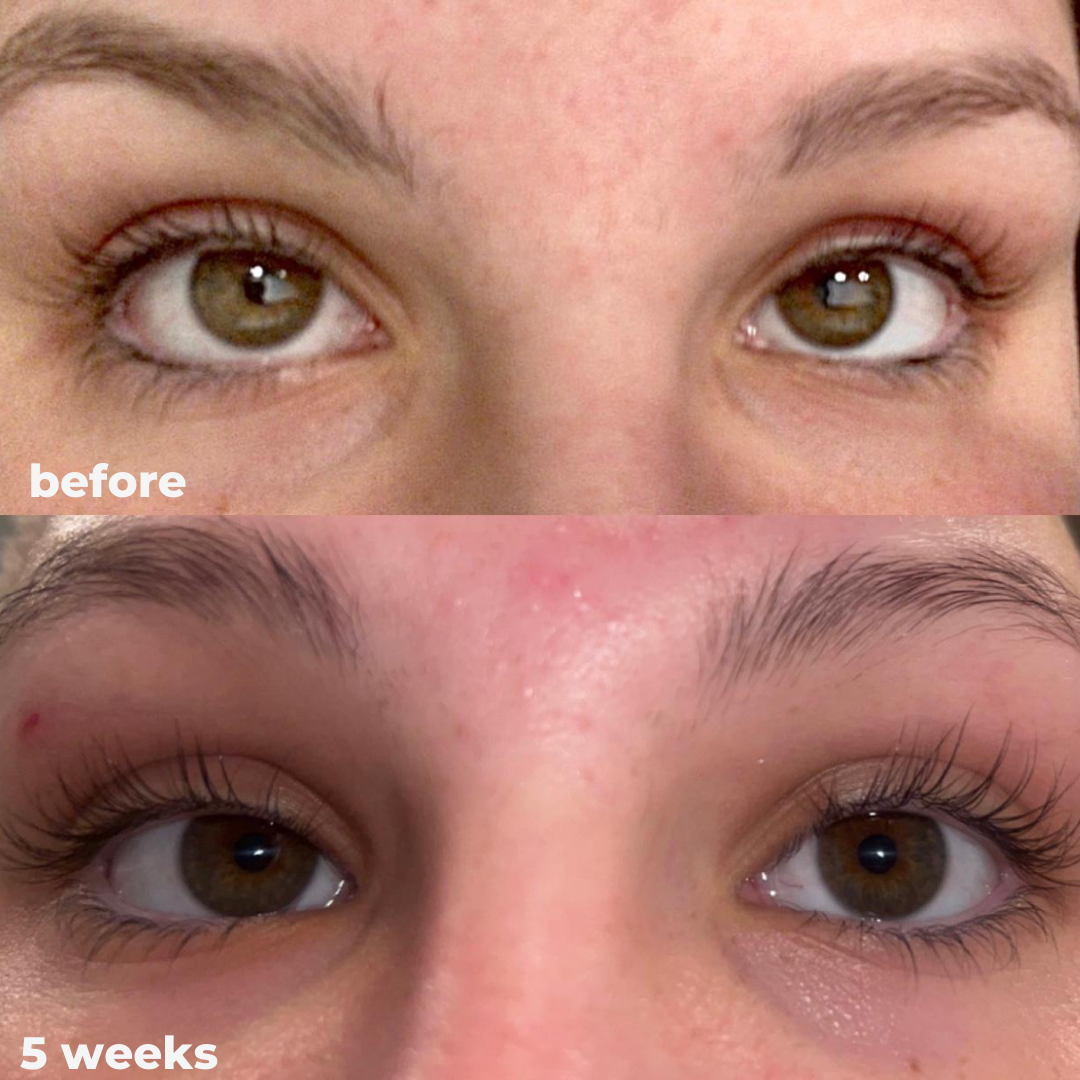 Magic Eyelash Serum