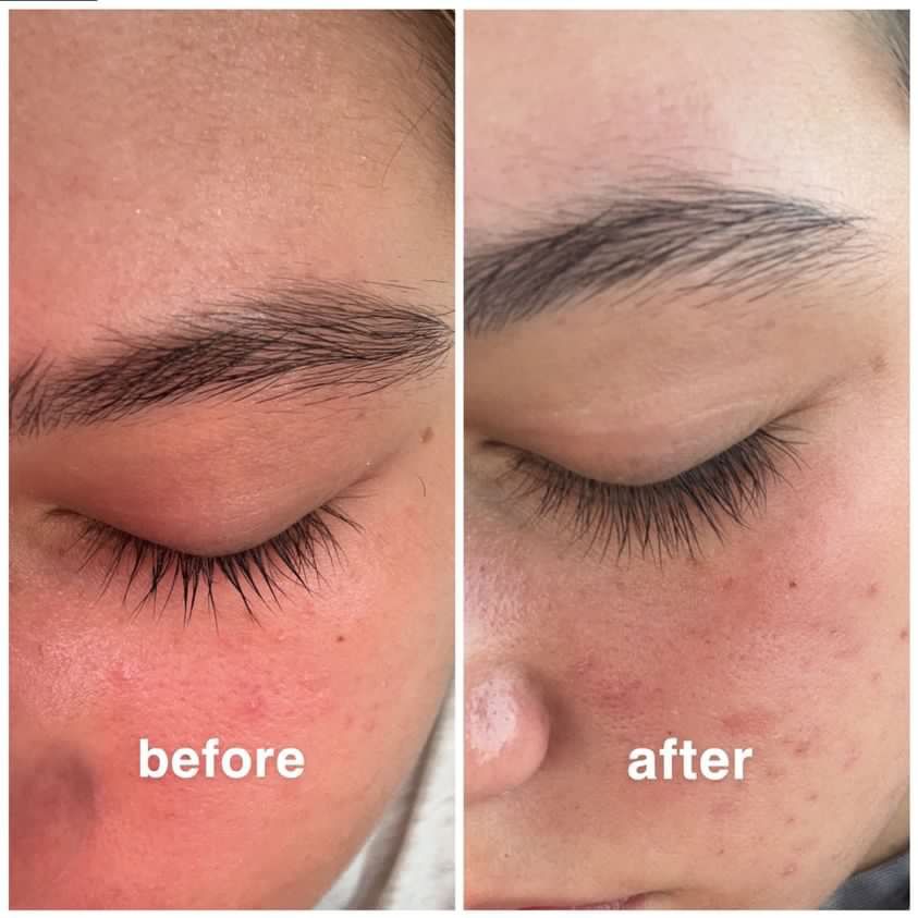 Magic Eyelash Serum